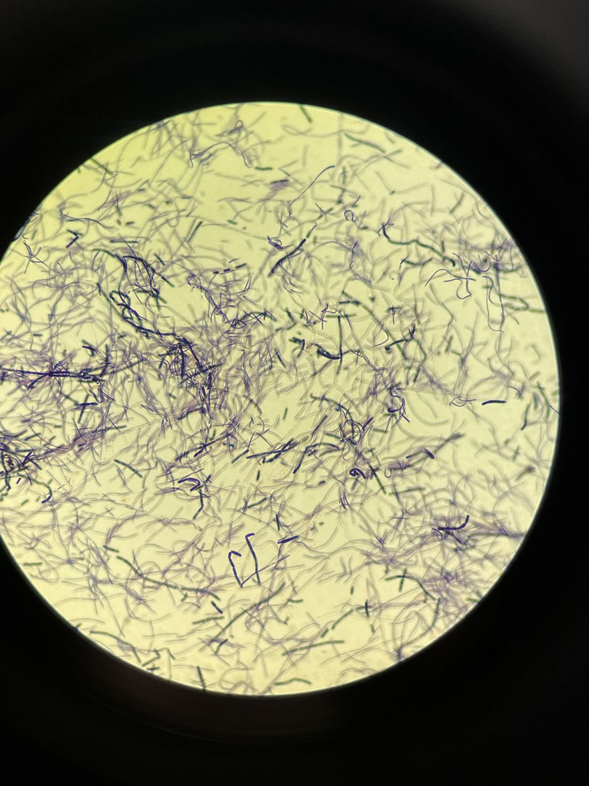 Prebiotic FOS
